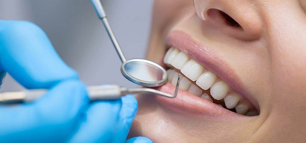teeth whitening method