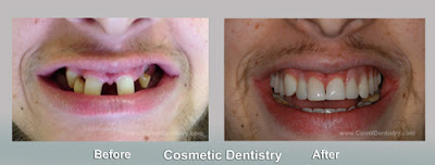 Carroll Dentistry, Cosmetic Dentistry, Miami Beach Dentist, Tooth Whitening, Family Dentistry, Bioclear, Bonding