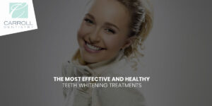 Read more about the article The Most Effective And Healthy Teeth Whitening Treatments