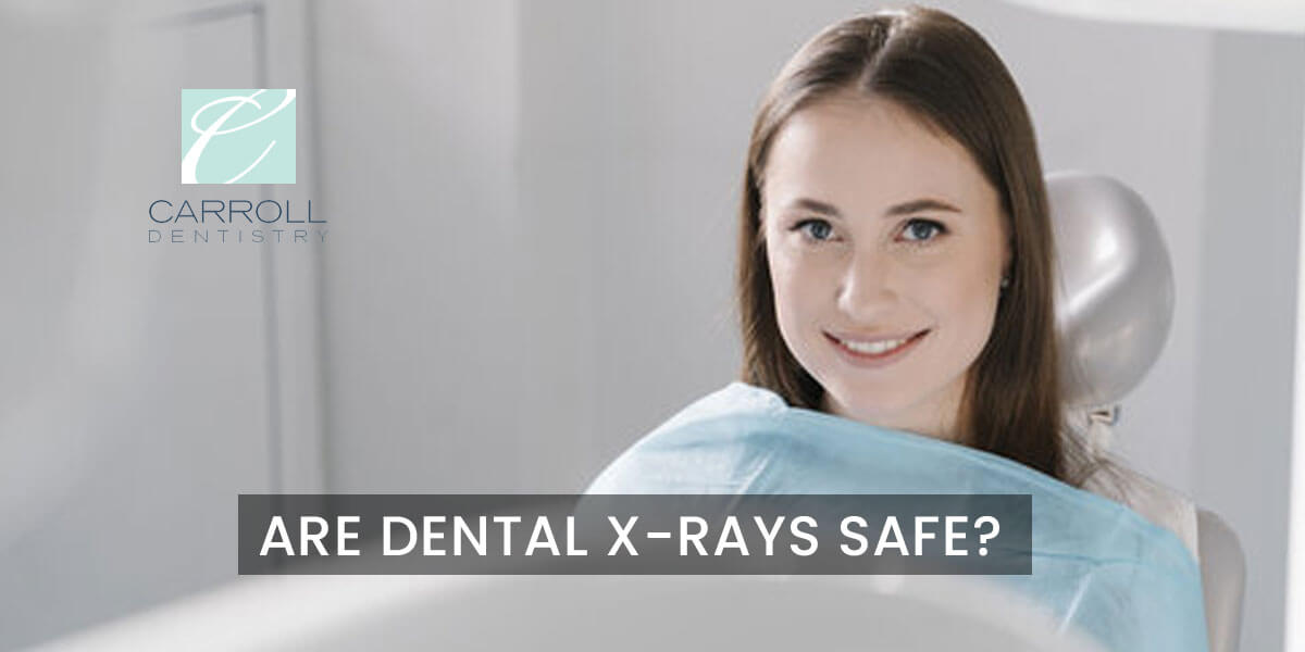 Read more about the article Are Dental X-Rays Safe?