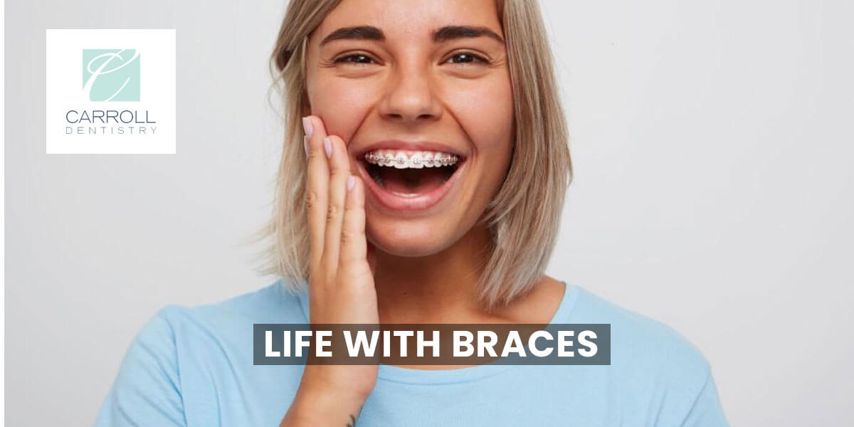 Read more about the article Life With Braces