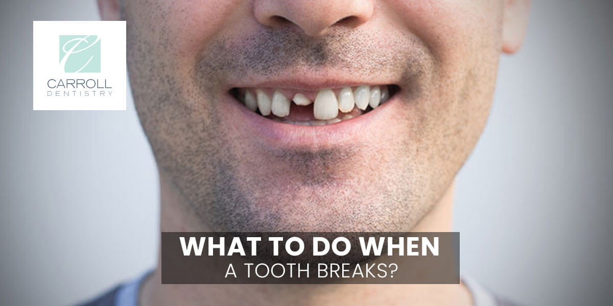 You are currently viewing What To Do When a Tooth Breaks?