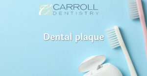 Read more about the article Dental Plaque
