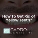 How To Get Rid of Yellow Teeth?