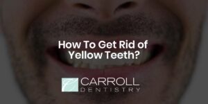 Read more about the article How To Get Rid of Yellow Teeth?