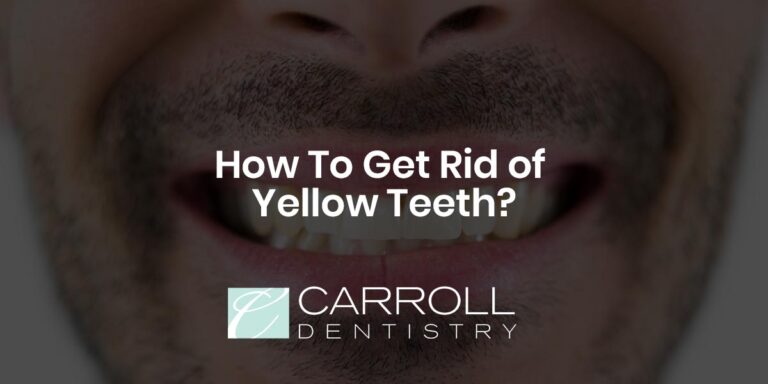 How To Get Rid of Yellow Teeth