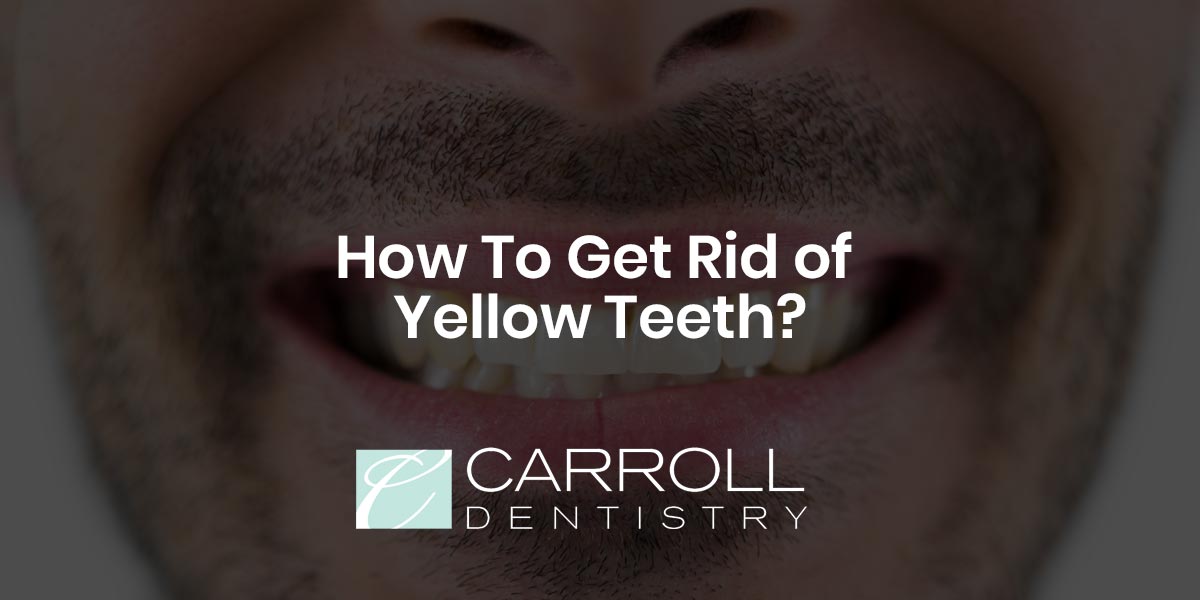 You are currently viewing How To Get Rid of Yellow Teeth?