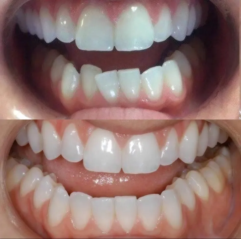 adult-orthodontics-slide-2