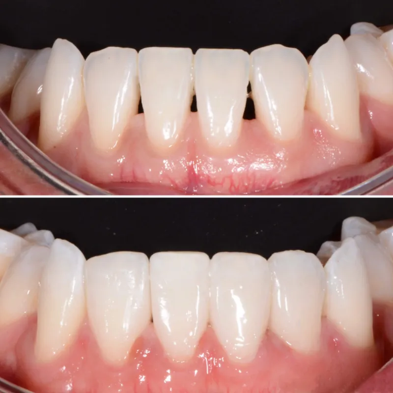 bioclear-slide-1