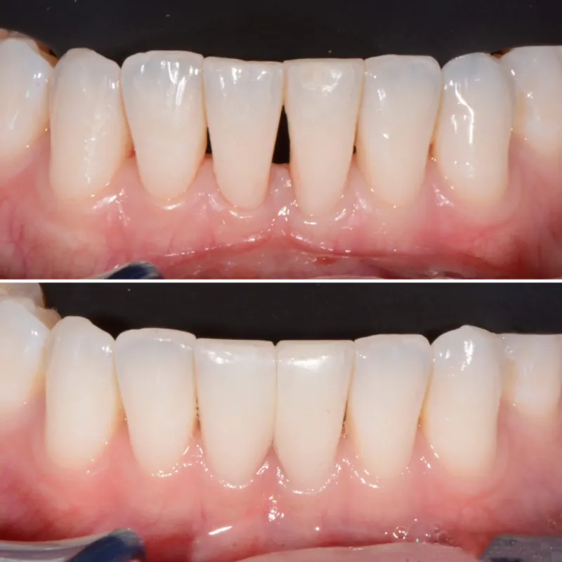 bioclear-slide-2