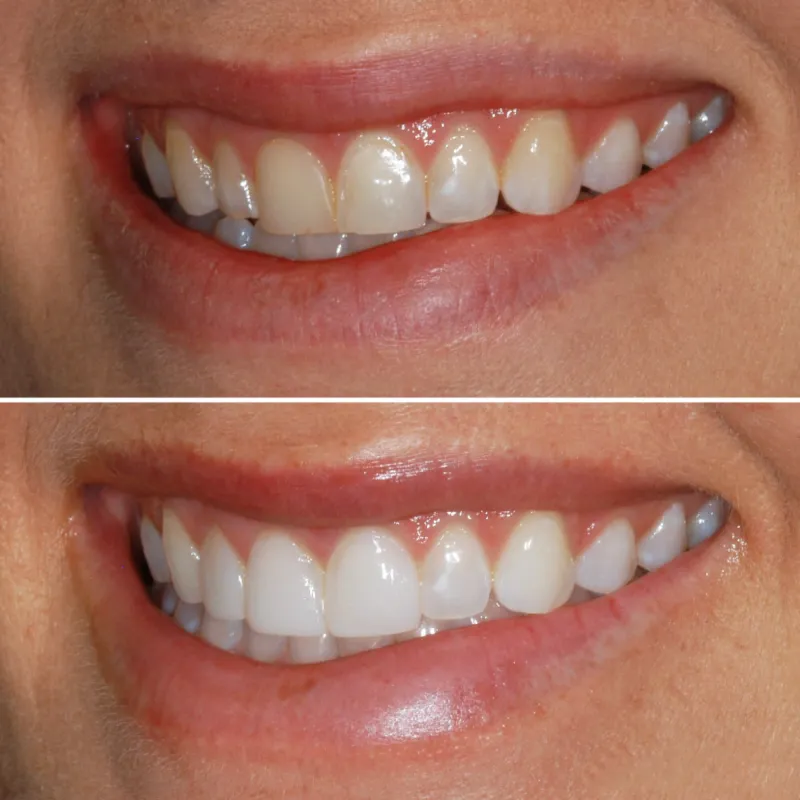 bioclear-slide-3