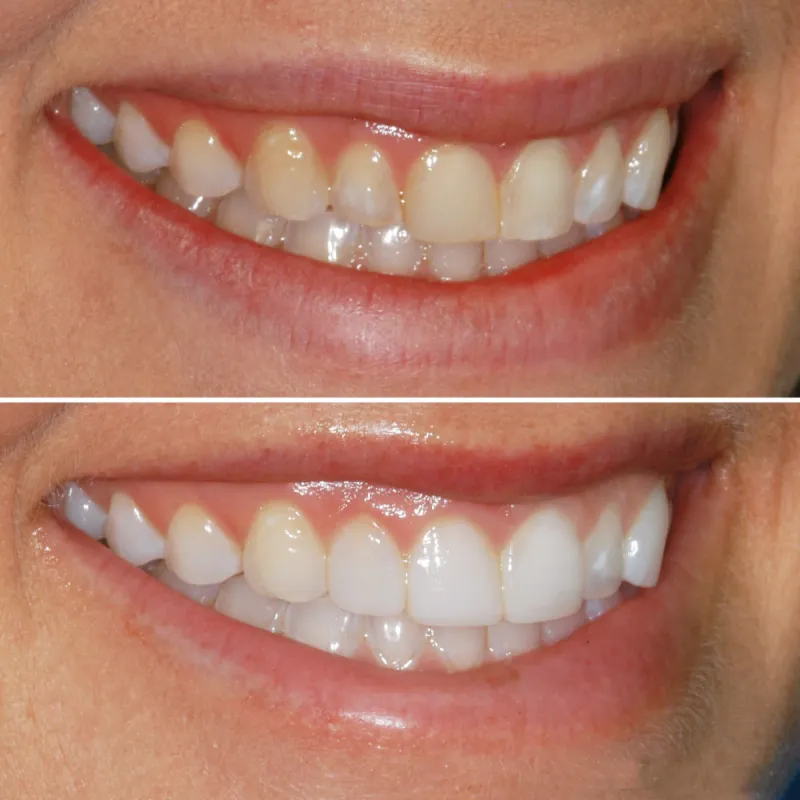 bioclear-slide-5