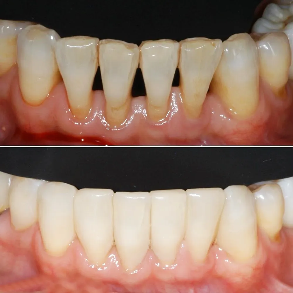 bioclear-slide-7